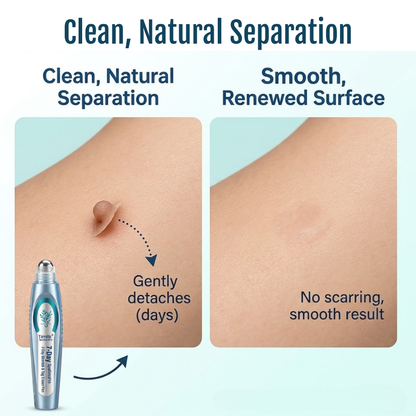 Timilk® SpotlessPro Advanced Skin Care Pen.
