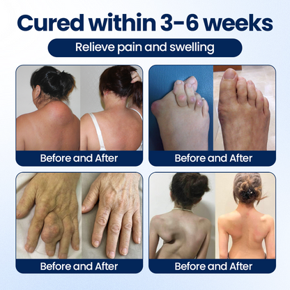 Timilk® ArthriNAD+ Pro Advanced Joint Recovery Cream
