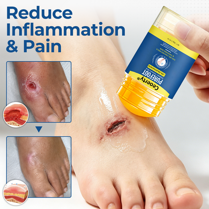 Ceoerty® PureFoot Foot Care Stick.